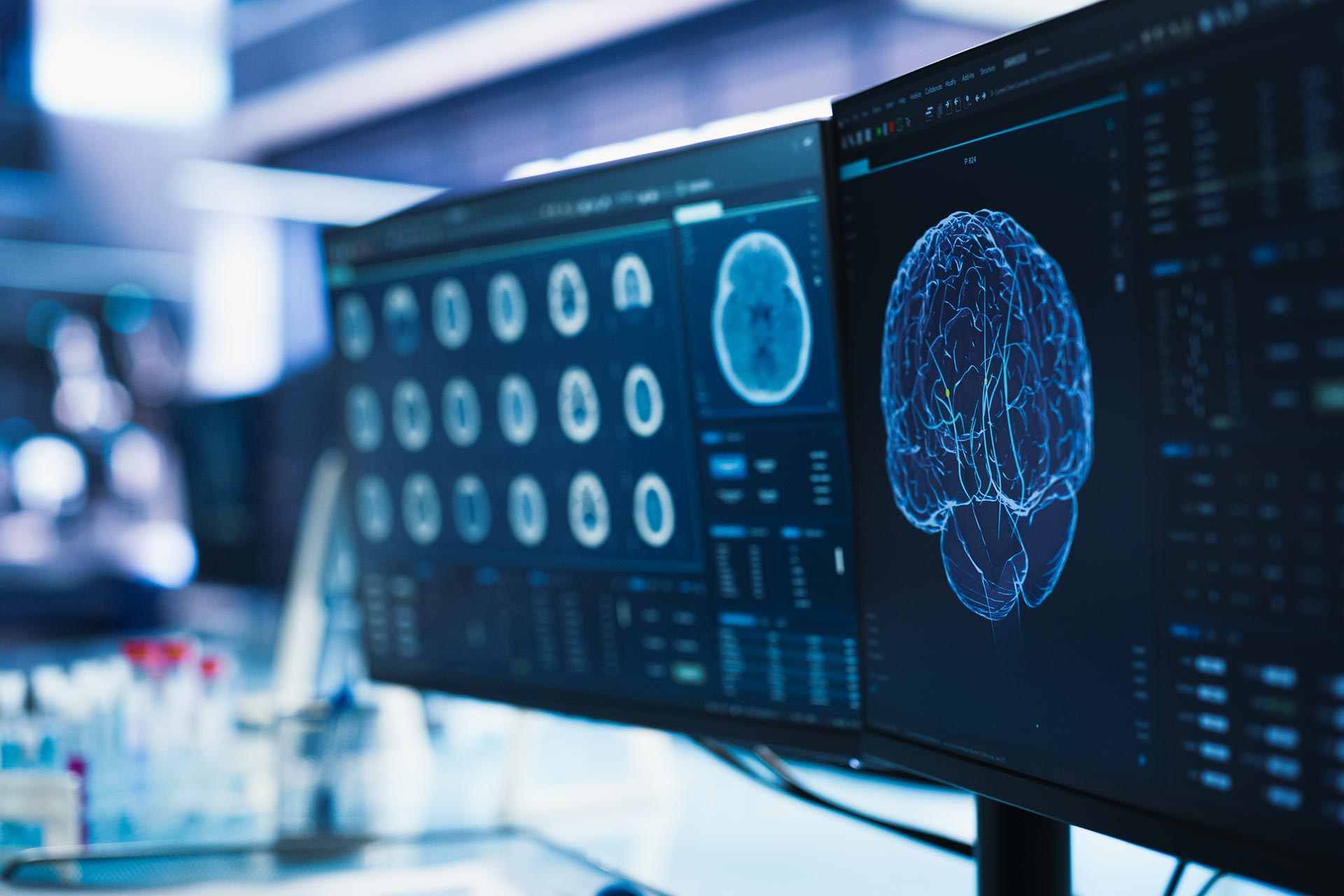Cancer-Research-Center-Medical-Laboratory---Close-Up-of-a-Set-of-Desktop-Computer-Monitors-Showing-CT-Scans-Of-Human-Brain---Specialist-Studying-Brain-Tumor---Finding-Solutions---Treatment---stock-photo