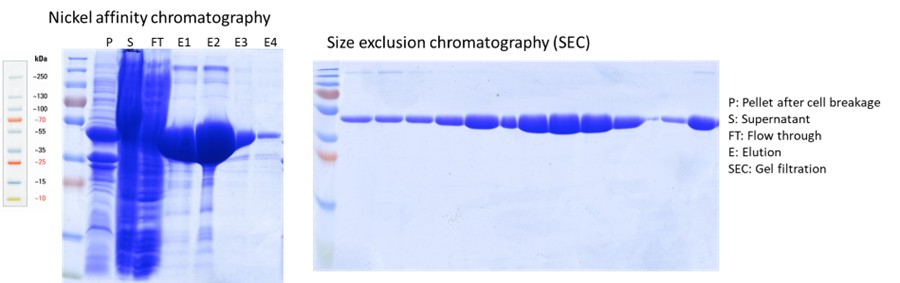 Images of SDS-PAGE gels, stained with coomassie blue, highlighting protein bands in dark blue with lighter blue for the gel background. The left-hand side of the image contains a protein ladder marker on the gel, and multiple bands before protein purification, the right-hand side of the image contains fewer bands and only shows the protein of interest which has been purified.