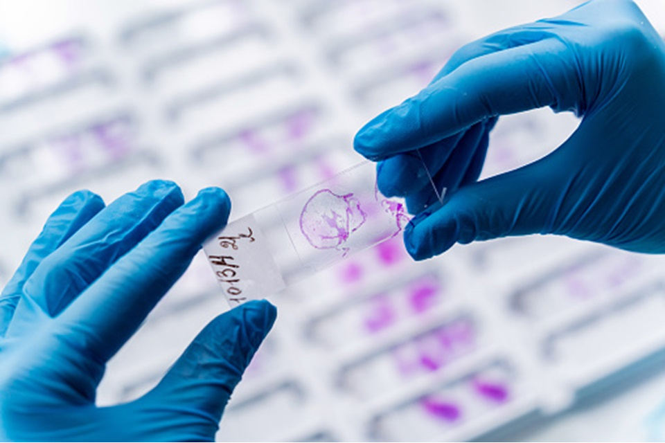 Hands in blue gloves holding glass histology slides