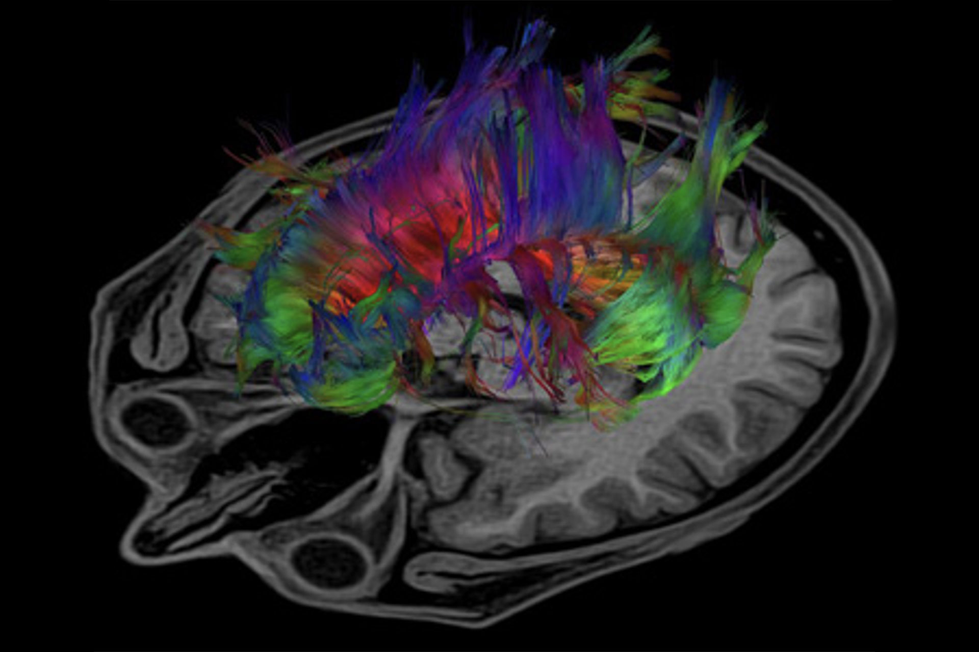 Image of a colourful brain scan