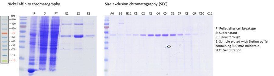 Images of SDS-PAGE gels, stained with coomassie blue, highlighting protein bands in dark blue with lighter blue for the gel background. The left-hand side of the image contains a protein ladder marker on the gel, and multiple bands before protein purification, the right-hand side of the image contains fewer bands and only shows the protein of interest which has been purified.