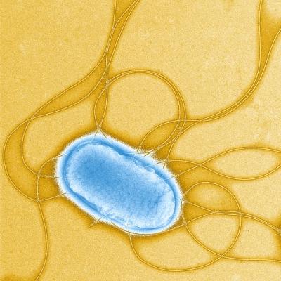 Salmonella Typhimurium illustrated