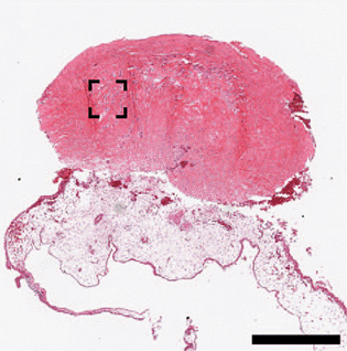 Image of scanned egg