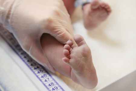 A newborn baby's leg being measured 