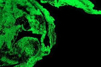 A screenshot taken from the stroke paper produced by scientists at the University of Liverpool