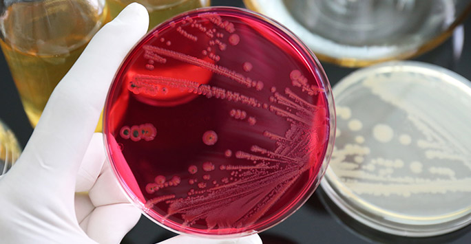 Salomonella growth in petri dish