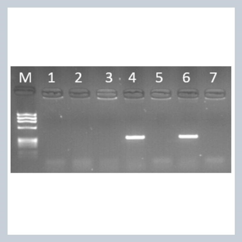 Image of laboratory test