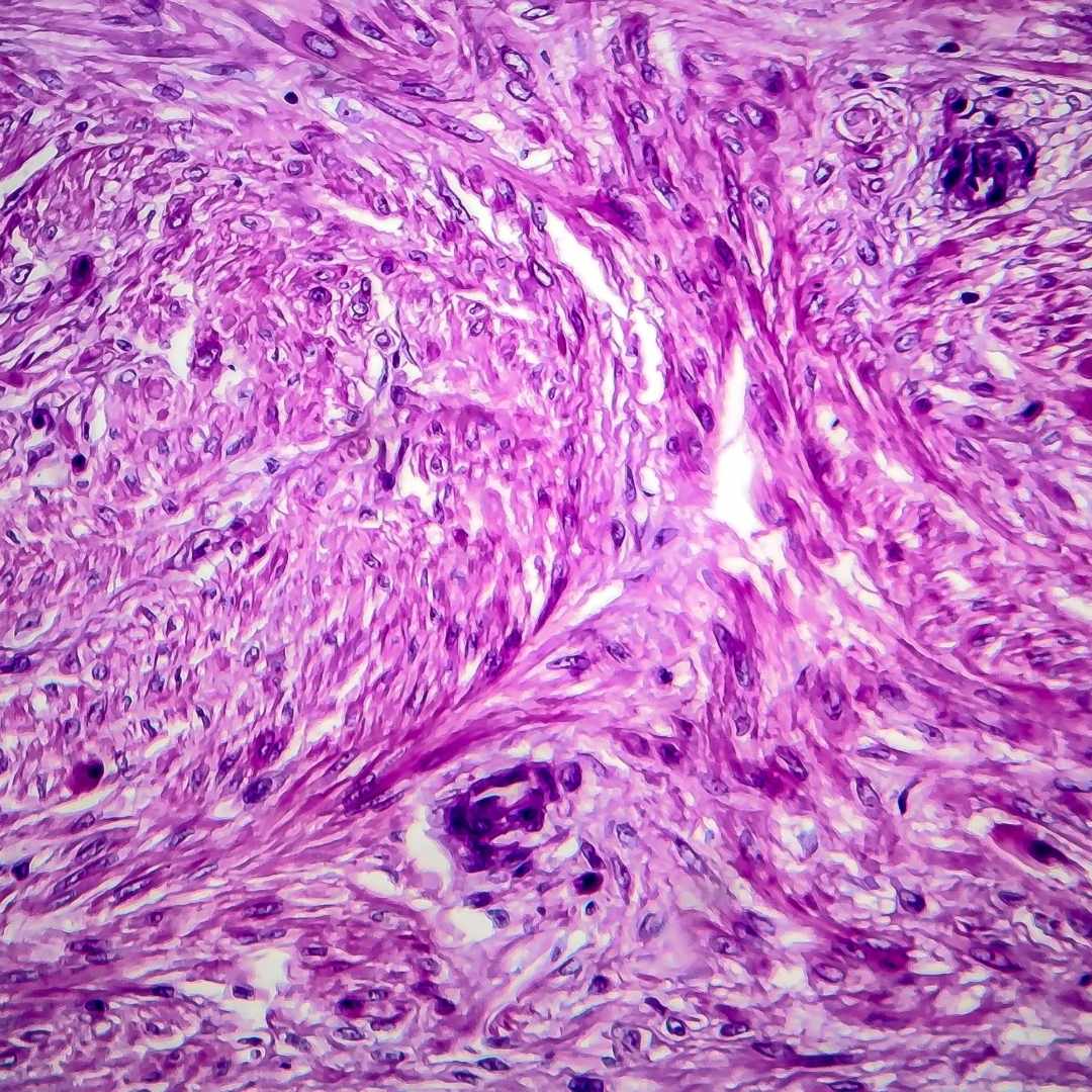 Image of stained histpathology slide