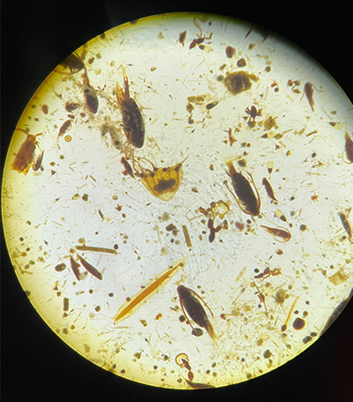 A diverse collection of plankton seen using a microscope