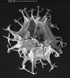 Spiniferites ramosus dinoflagellate cyst