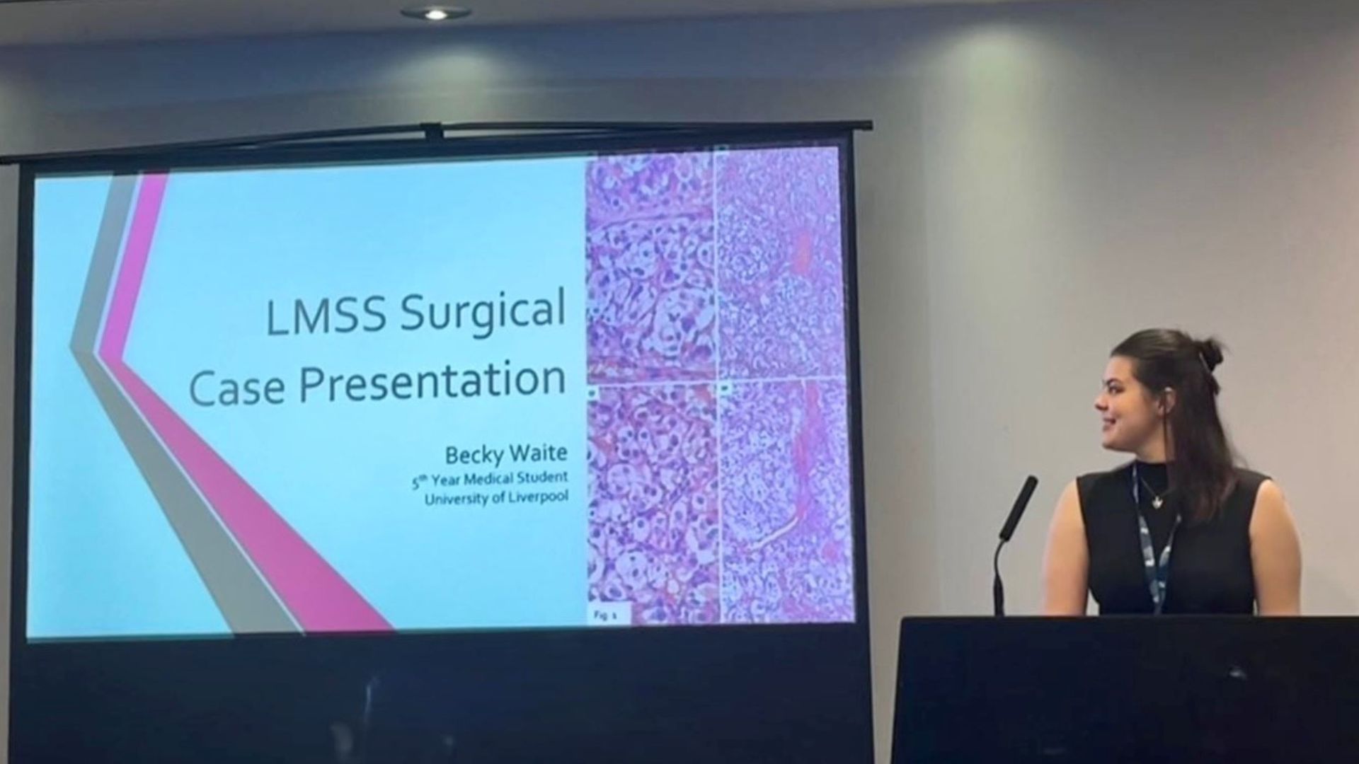 LMSS surgical case presentation evening. Becky Waite presented a case about a rare carotid body tumour