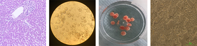 Liver samples