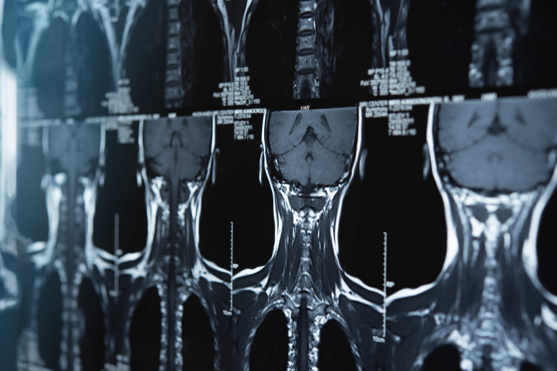 Cervical Spine x-ray images