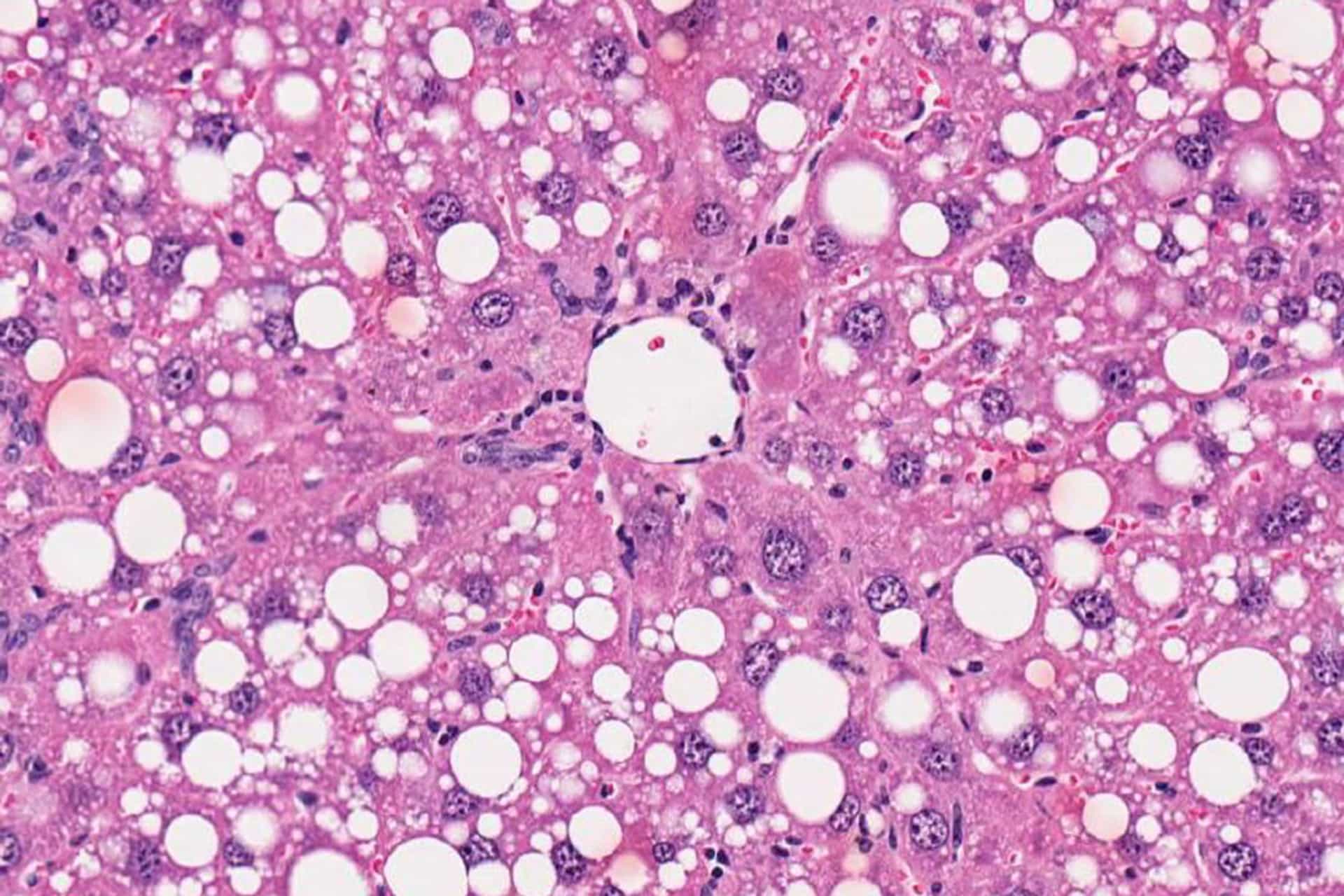 Liver cells under microscope