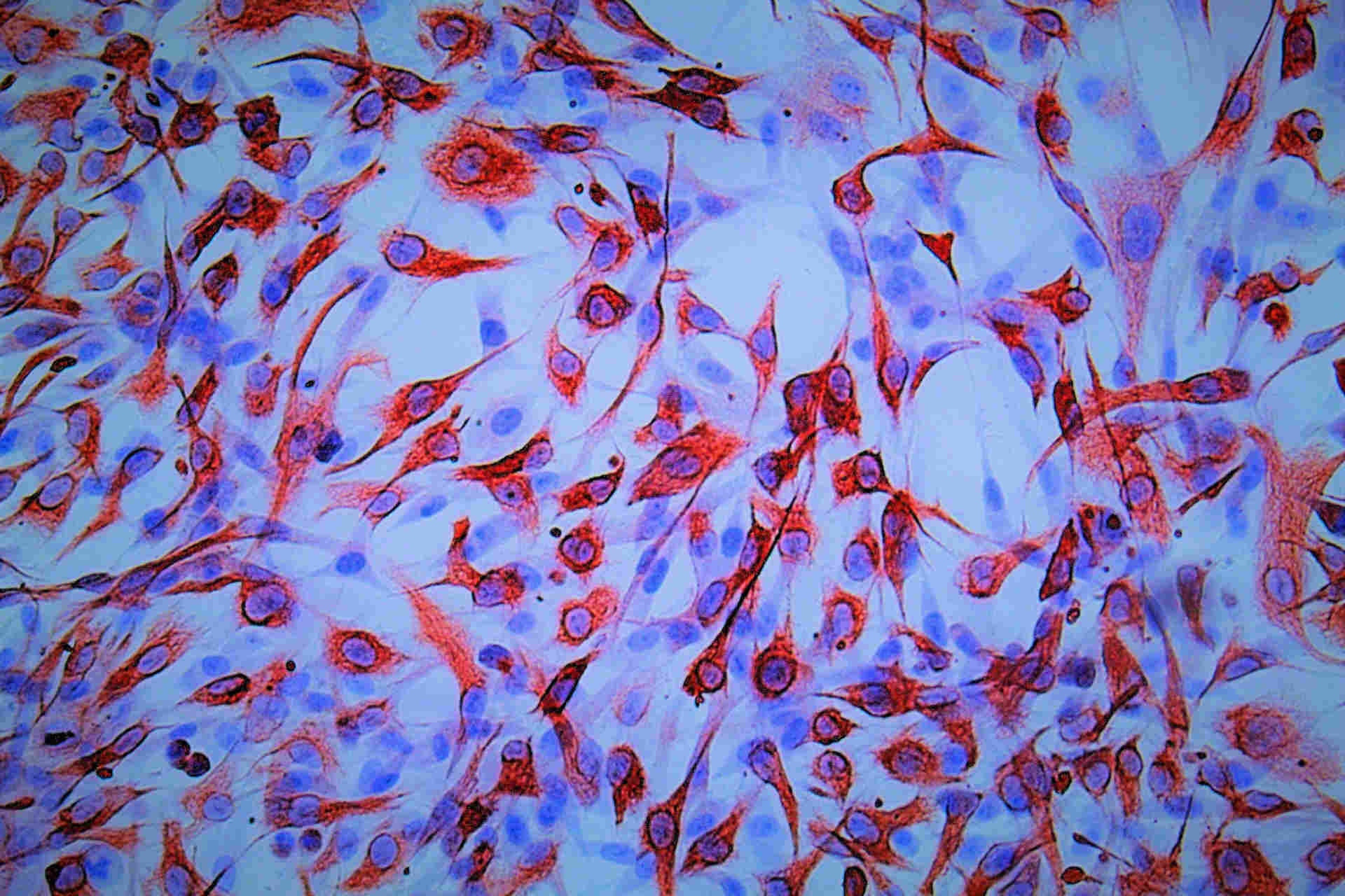 uveal melanoma cell lines