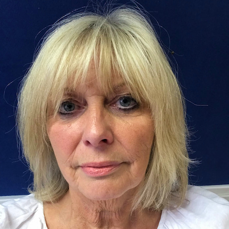 Anne-Louise Humphreys