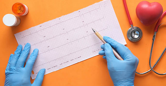 Someone reading a heart monitor report.