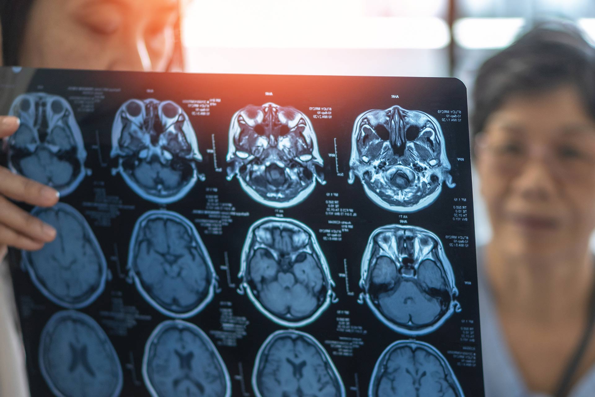Magnetic-Resonance-Imaging-MRI-film-for-Brain-disease-diagnosis-with-medical-doctor-diagnosing-elderly-ageing-patient-neurodegenerative-illness-problem-seeing-for-neurological-medical-treatment---stock-photo