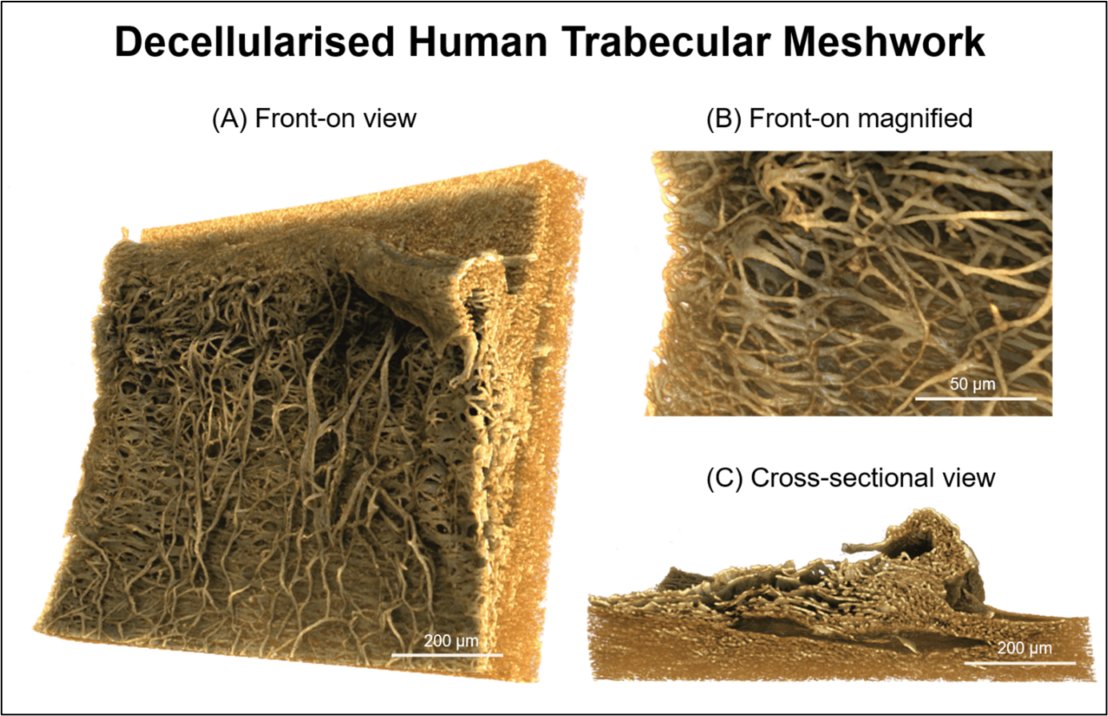 Three volume renderings of a trabecular mesh tissue sample from an eye, showing the fibrous structure.