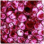 Biofilm - C. albicans